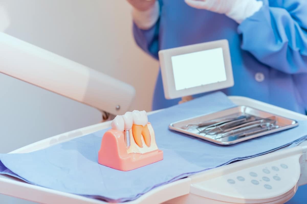 Vue d'une couronne et bridge esthétique