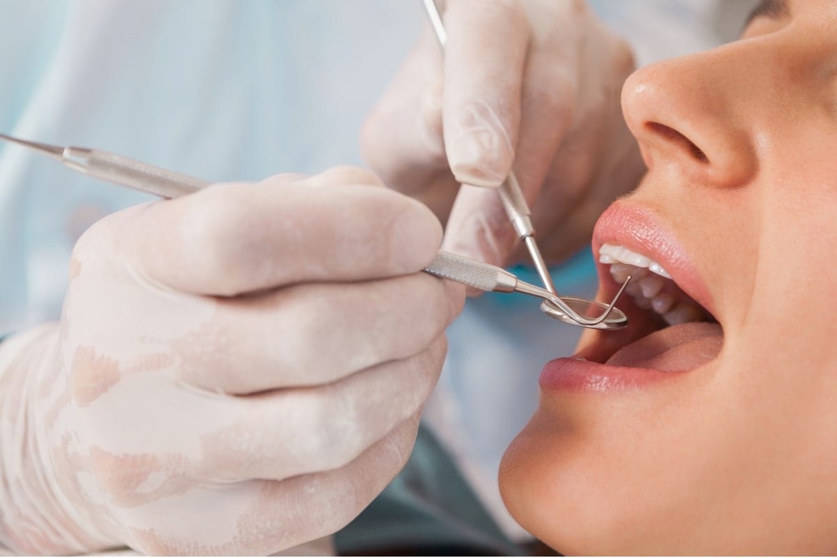 Détartrage au cabinet dentaire de Piton Saint-leu